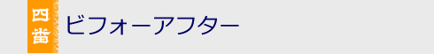 ビフォアーアフター